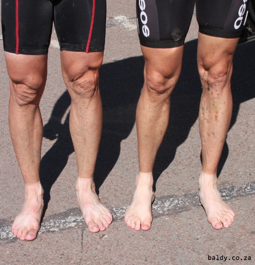 Feet after a muddy MTB ride